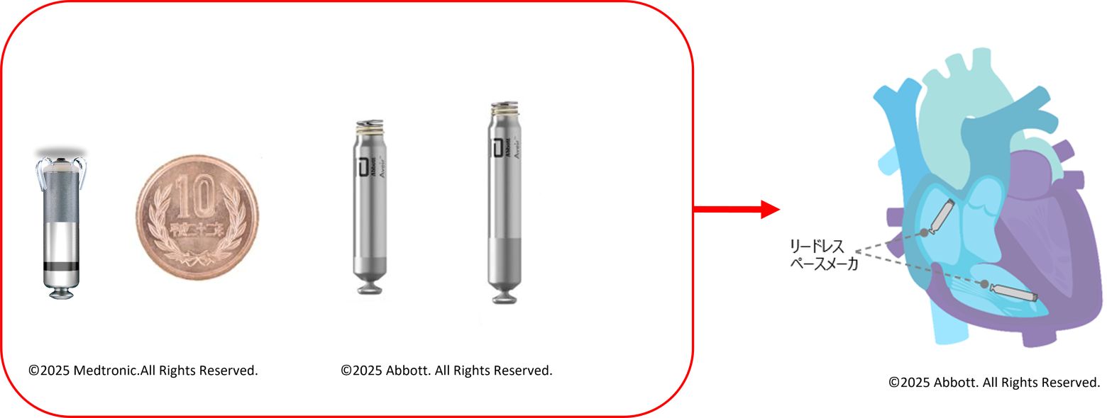 リードレスペースメーカーイメージ